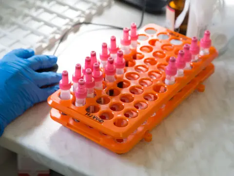 Sample tubes in a rack on a laboratory bench, a gloved hand beside them